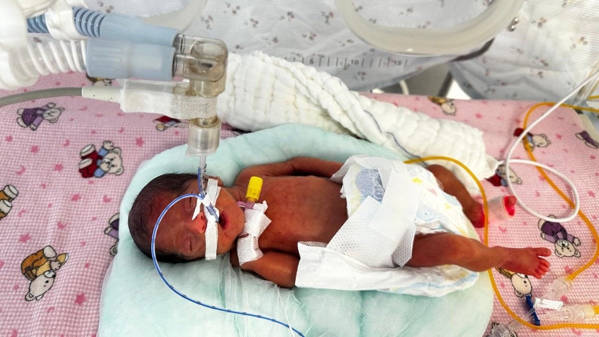 Antalya'da 650 gram doğan bebek hayata tutundu