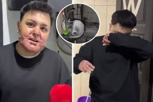 65 ameliyat geçirdi, 12 gün uyutuldu! Hayatı saniyeler içinde kabusa döndü