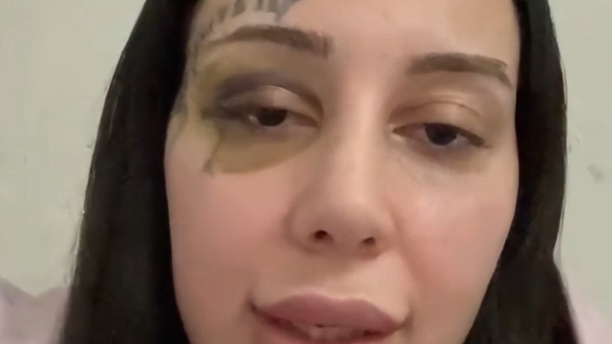 İsatnbul’da eşi tarafından sokak ortasında darbedilen Yağmur: Tecavüz etti hamile kaldım, evlendik