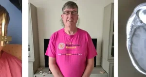 Kulak çınlamasını hafife aldı, gerçek MR’da ortaya çıktı: Ameliyat edilemeyen beyin tümörüyle karşı karşıya kaldı