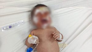 Şanlıurfa’da kendiliğinden yanan ev: 2 aylık bebek yanarak yaralandı