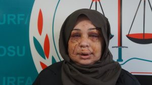 Ankara’da polis eşinden şiddet iddiasıyla şikayetçi oldu