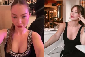 Danla Bilic altıncı kez ameliyat masasına yatacak: Yanlış dolgu operasyonunun sonuçları