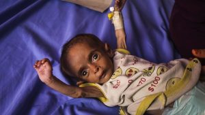 DSÖ: Gazze’de 18 bin 500’den fazla hastanın tahliye edilmesi gerekiyor