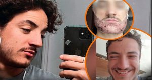 Emlakçının sakal operasyonu yaptığı İngiliz genç öldü