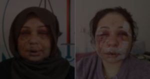 Eşini hastanelik eden polis, ifade verip serbest kaldı