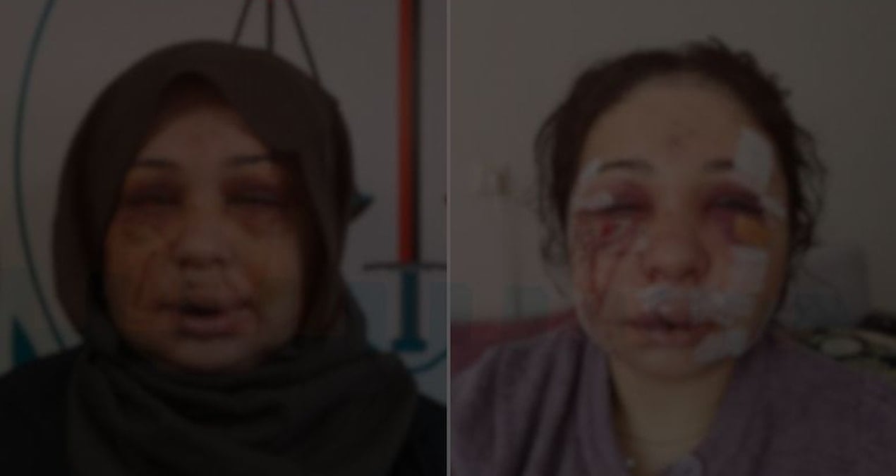 Eşini hastanelik eden polis, ifade verip serbest kaldı