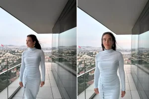 Müge Boz, 20 yıldır mücadele ettiği sedef hastalığını açıkladı