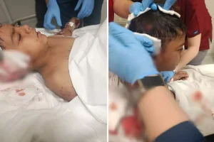 Okul çıkışı sokak köpeklerinin saldırdığı Davut yaralandı