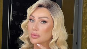 Seda Sayan yüzündeki şişliğin nedenini açıkladı