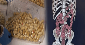 Vücutlarından  29,7 kilo uyuşturucu çıktı