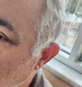 Aile hekimini darbeden müezzin, savcılığın itirazıyla gözaltına alınıp tutuklandı