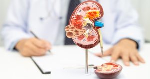 Böbrekleri ‘altın’ gibi koruyan besinler