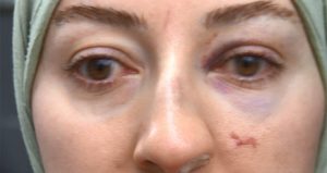 Çığlığı duyan koştu… Video kaydediyor diye kadını bu hale getirdiler