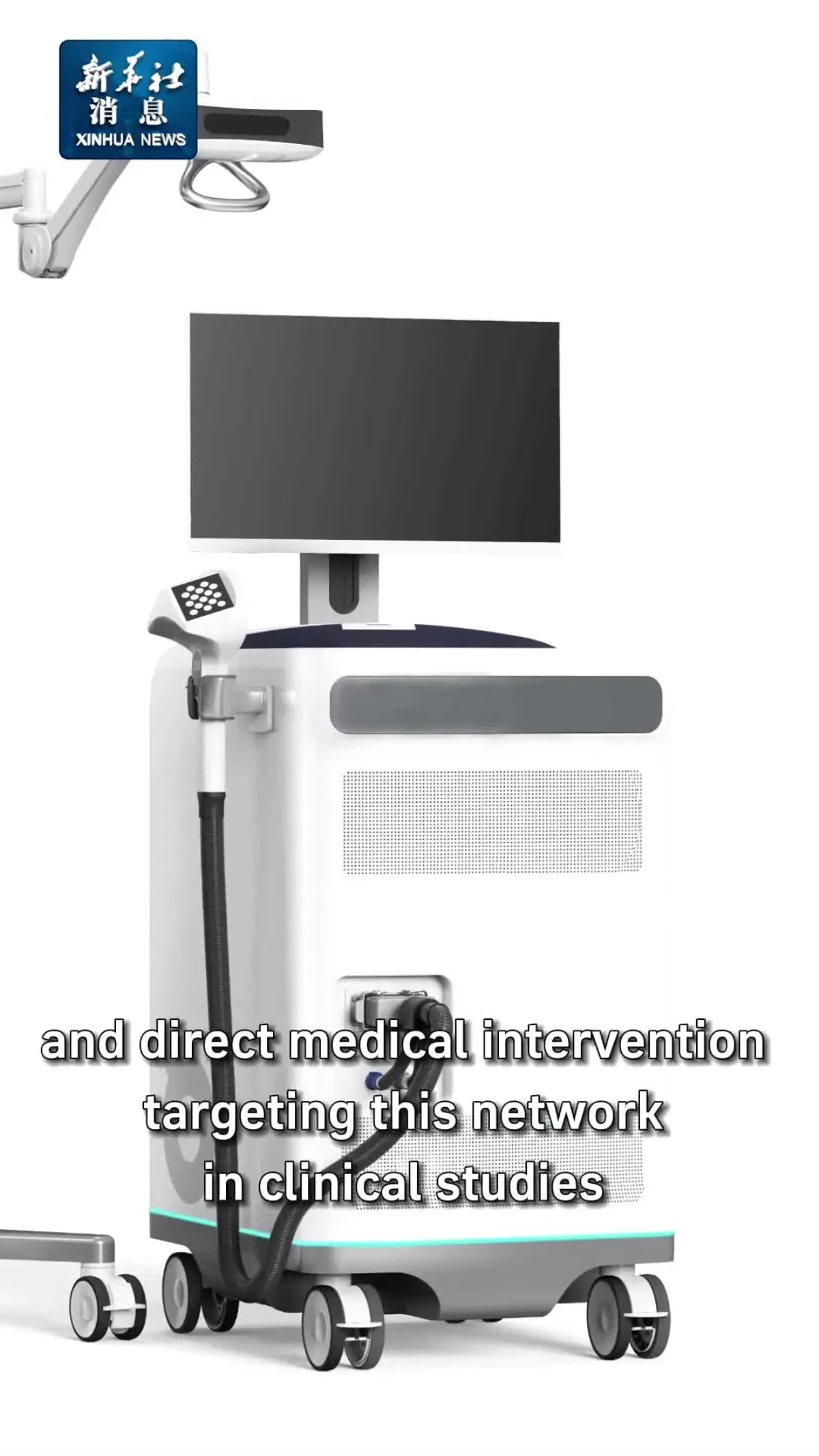 Çinli Bilim İnsanları Parkinson Ağı Keşfetti