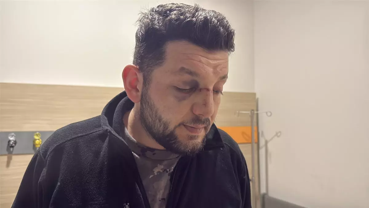 Çocuk Gürültüsü Tartışması Kanlı Bitti