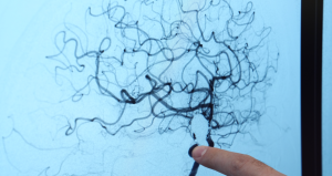 Doktorlar uyardı, her 20 kişiden 1’inde görülüyor