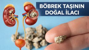 Her gün 1 avuç yiyin: Böbrek taşını kaydırıp atıyor…