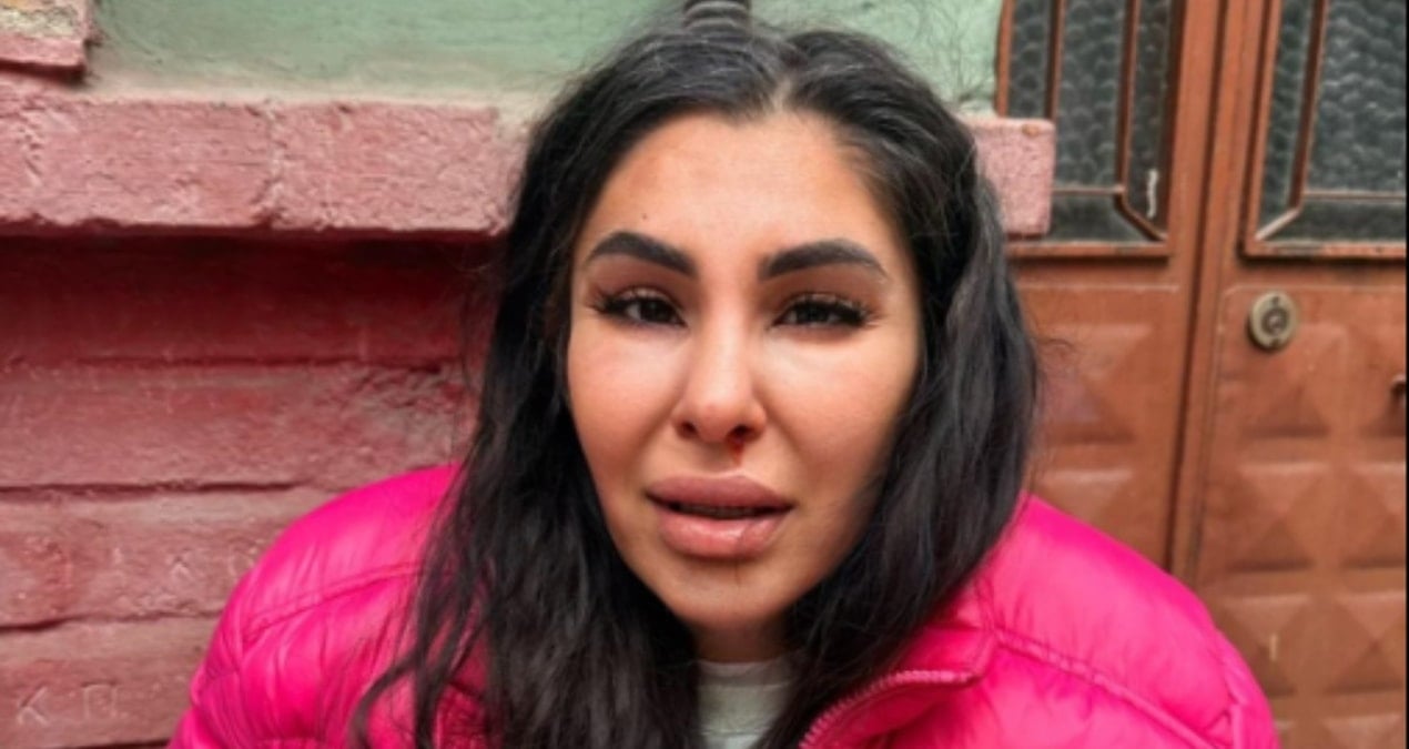 İstanbul’da yasak aşk kabusu: Ayrılmak isteyen kadın avukattan dayak yedi