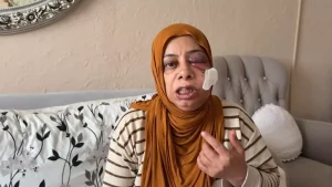 Rögar Kazası: Elektrikli Bisikletli Kadın Yaralandı