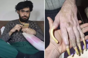 Türkiye’nin konuştuğu Barış’ın yeni işini ve son halini görenler şaşıp kalıyor