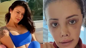 Yüz nakli yaptıran Didem Ceran’ın son hali: Harika gözüküyorum