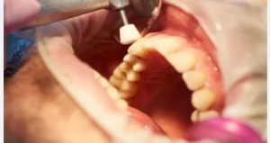 Diş yaptırmak isterken evsiz kaldı! İcra memurları evini ve arabasını haczetti