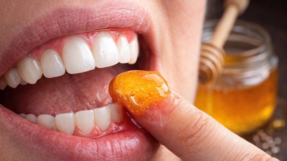 Doğal ilacı çıktı! Diş etlerine bal sürmek dişçiden kurtarıyor…