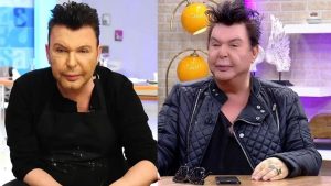 Estetik olmuştu! Kuşum Aydın’ın yüzünün son halini paylaştı