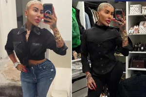 Kim Kardashian’a benzemek için estetik yaptıran fenomen hayatını kaybetti: 2 kişi cinayetten tutuklandı