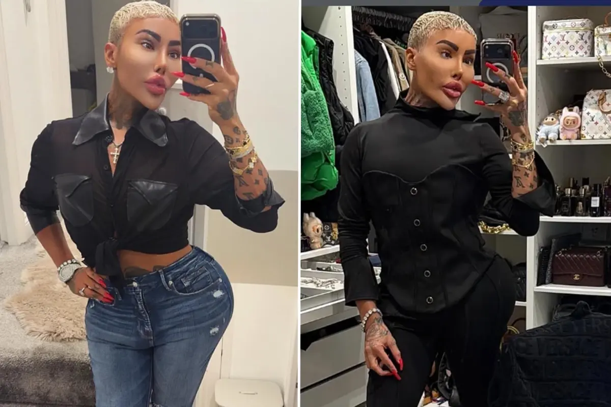 Kim Kardashian’a benzemek için estetik yaptıran fenomen hayatını kaybetti: 2 kişi cinayetten tutuklandı