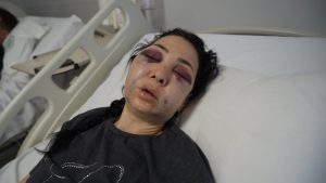 Kocaeli’de gittikleri kafede anne ve oğlu darbedildi