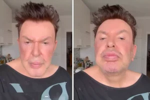 Kuşum Aydın estetik sonrası son halini paylaştı! Değişimi gündem oldu