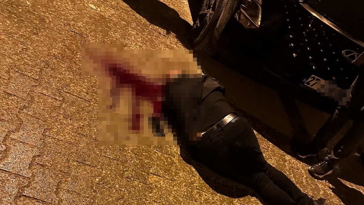 Şırnak’ta yürürken başından vuruldu