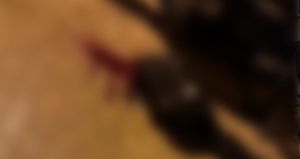 Sokakta yürürken tabanca ile başından vuruldu