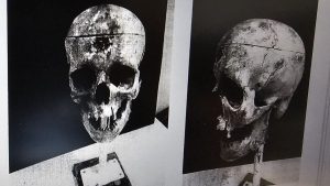 Zonguldak’ta barajda bulunan kemikler 18 yıllık cinayeti ortaya çıkardı